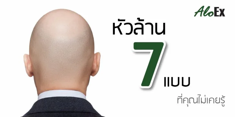 7 types of baldness