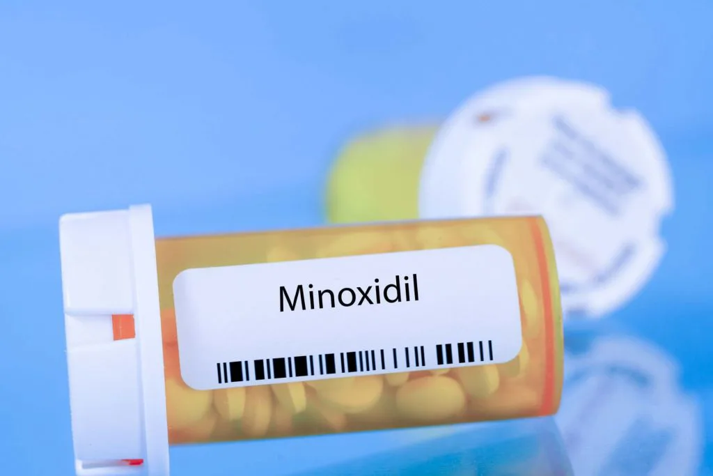 Oral Minoxidil