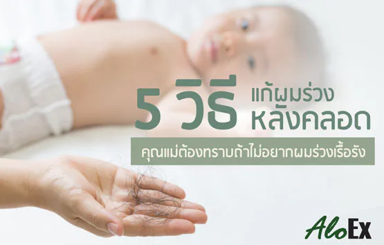 မွေးပြီးဆံပင်ကျွတ်ပြဿနာ ကုသနည်း ၅ နည်း
