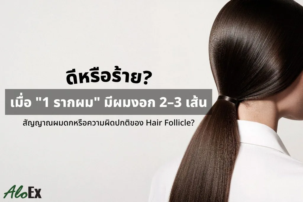 ดีหรือร้ายเมื่อ 1 รากผม มีผมงอก 2-3 เส้น