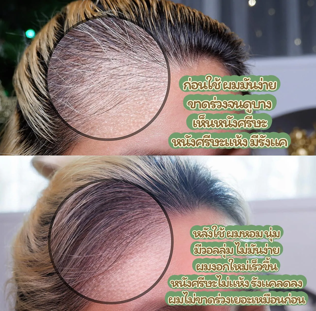 AloEx Extra Mild Natural Hair Regrowth Shampoo ကို အရေပြားအထိအခိုက်မခံသူများ၊ အထူးသဖြင့် ယားယံလွယ်သူများအတွက် ဖော်စပ်ထားသည်။