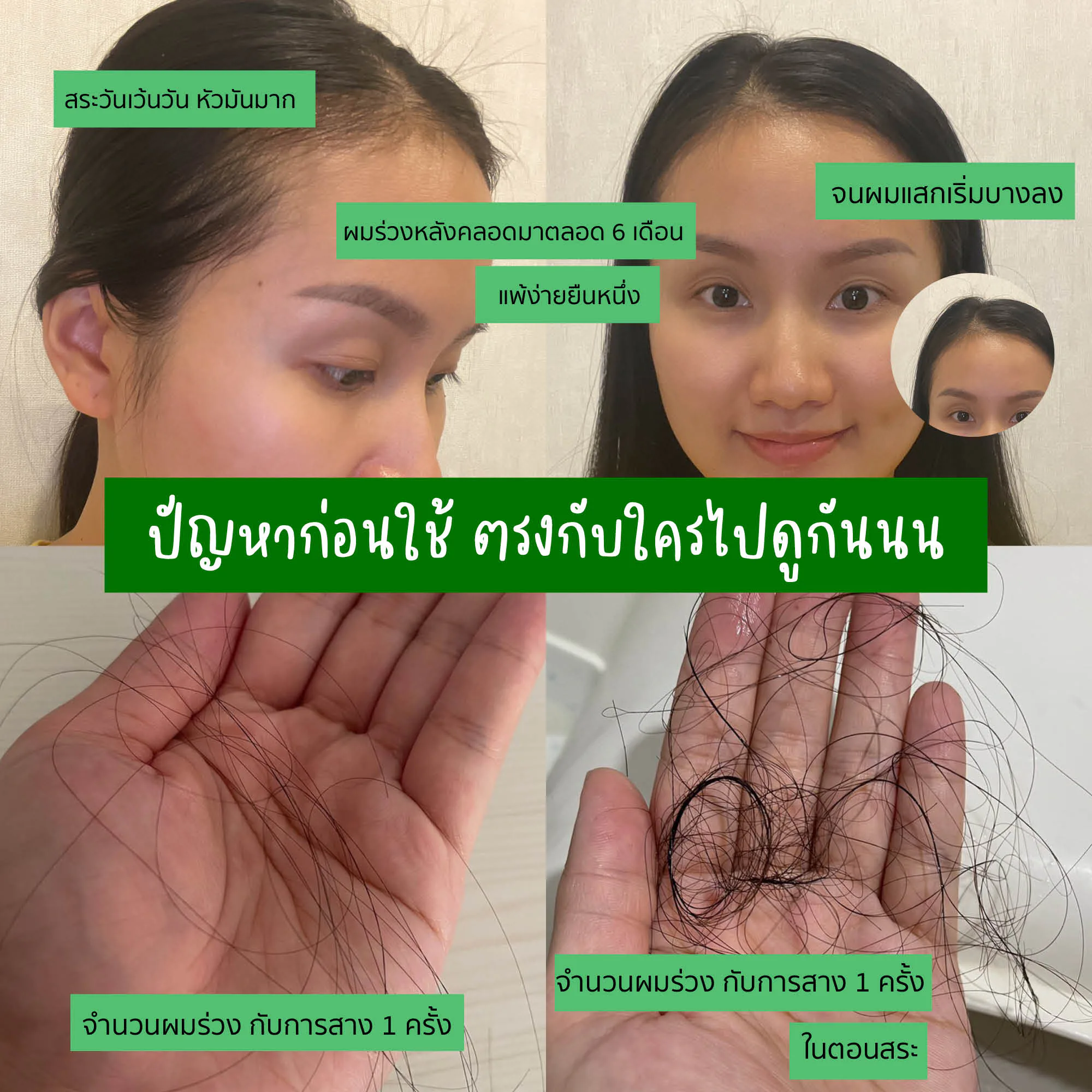 မွေးပြီးခါစမိခင်များနဲ့ အရေပြားအထိအခိုက်မခံသူများအတွက် ဆံပင်ကျွတ်ကာကွယ်ရာမှာ ကူညီပေးတဲ့ ရှန်ပူးနဲ့ ပြန်လည်ကြိုဆိုပါတယ်: AloEx Extra Mild။