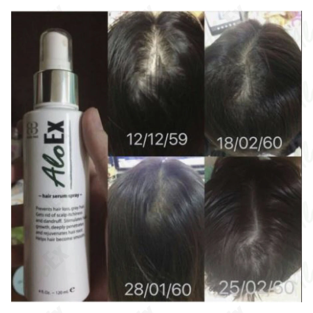 AloEx Serum မသုံးမီနှင့် သုံးပြီးနောက်