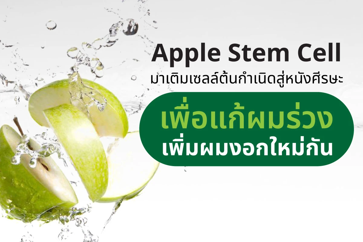 Apple Stem Cell: ဆံပင်ပျက်ကျမှုကို ဖြေရှင်းပြီး ဆံပင်အသစ်ပေါက်စေရန် ဦးရေပြားရှိ stem cell များကို ပြန်လည်ဖြည့်တင်းပေးခြင်း။