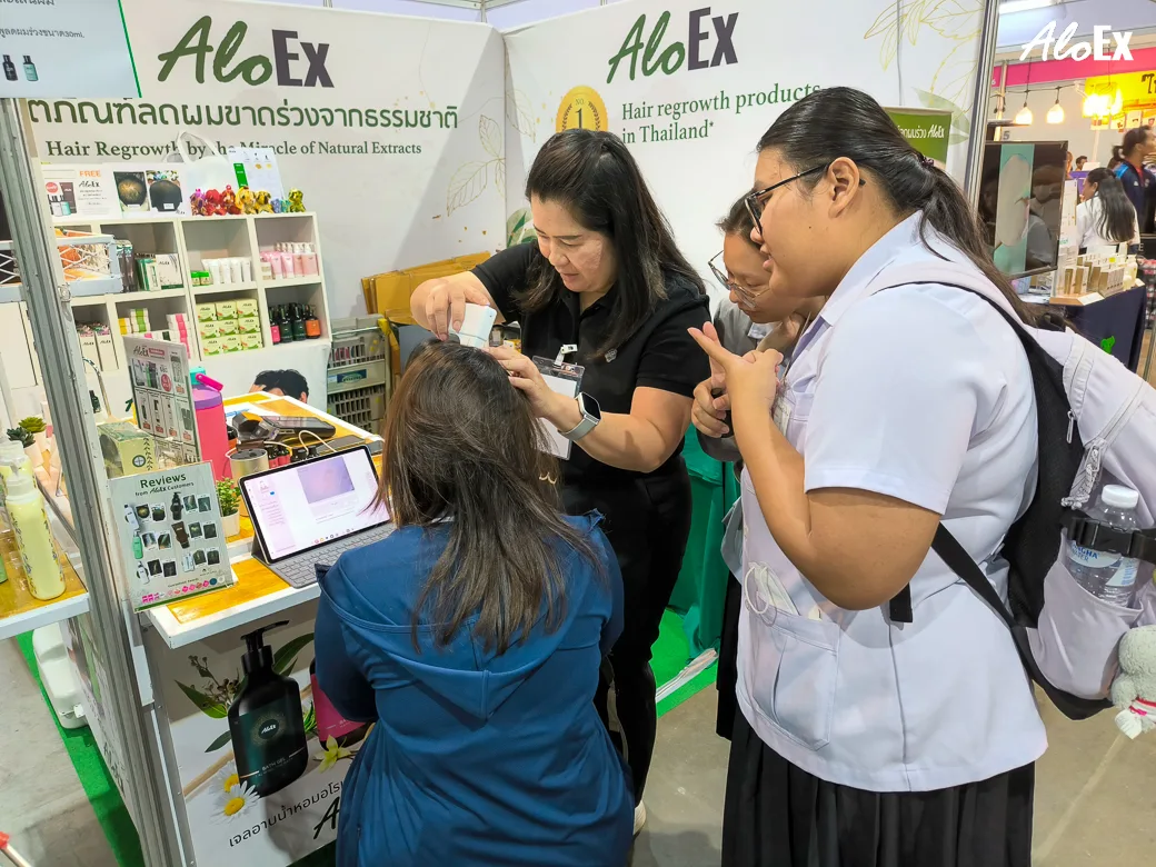 ผู้เชี่ยวชาญ AloEx ให้คำปรึกษาตรวจสภาพเส้นผมและหนังศีรษะฟรีที่บูธ B20