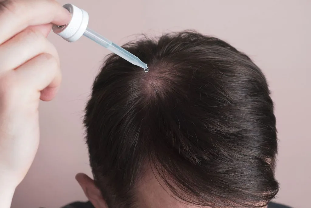 အပြင်လိမ်း Minoxidil