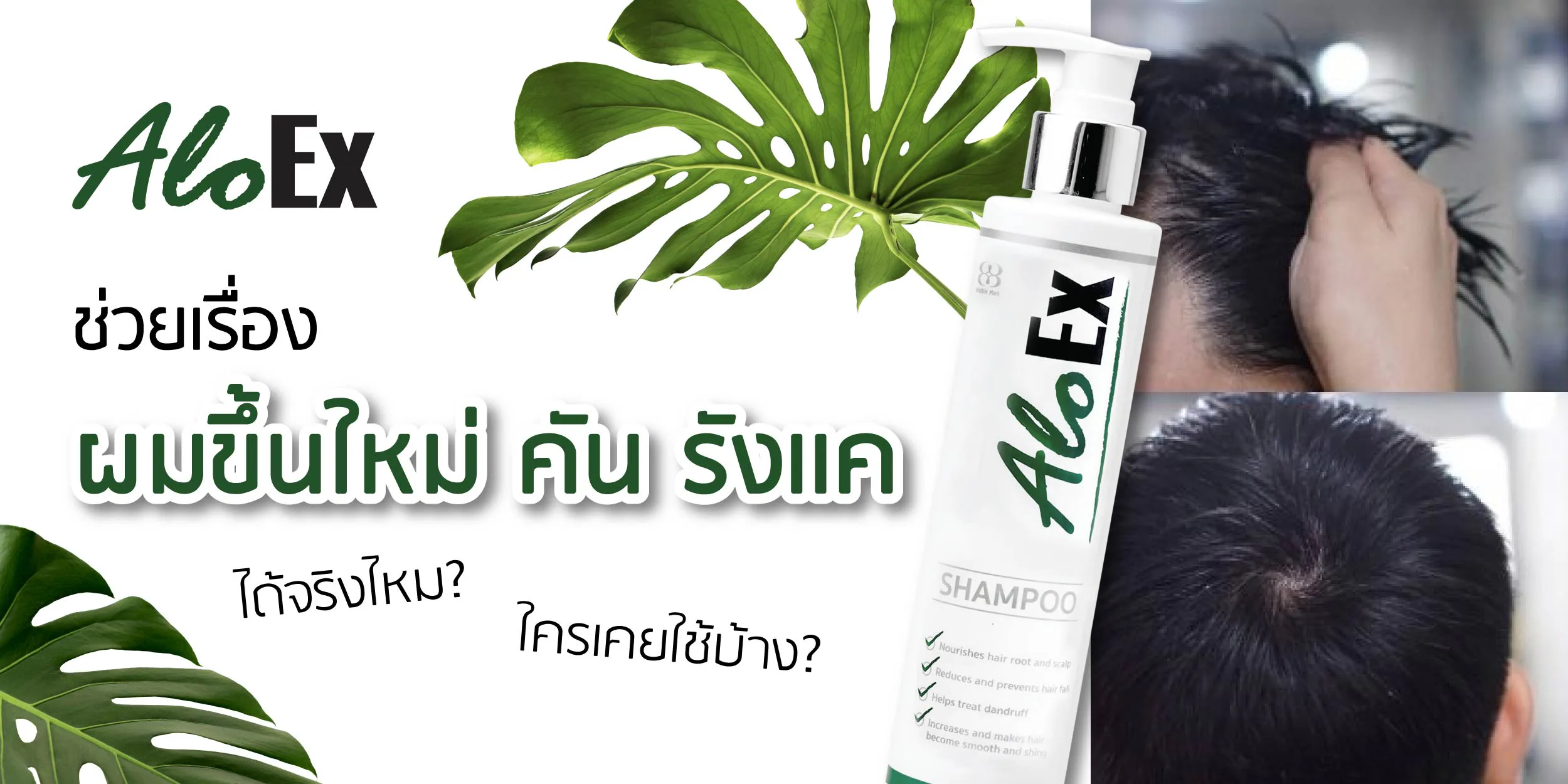 Does AloEx really help new growth, itchiness, and dandruff? Who has tried it?