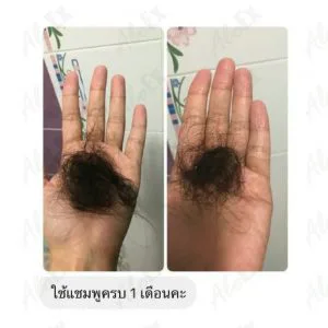 AloEx ရေးချိုးချောင်း သုံးမထည့်ခင်-သုံးပြီးနောက် ပြန်လည်သုံးသပ်ချက်