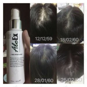 Before and after review: AloEx Hair Serum
