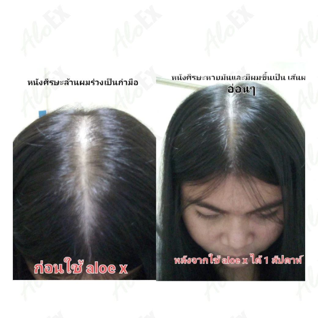 မသုံးမီနှင့် သုံးပြီးနောက် — AloEx ထုတ်ကုန်များ