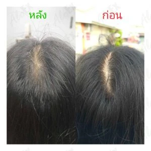 Before & After Reviews — AloEx Products