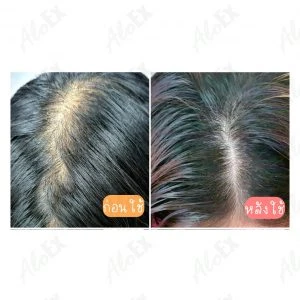 Before & After Reviews — AloEx Products