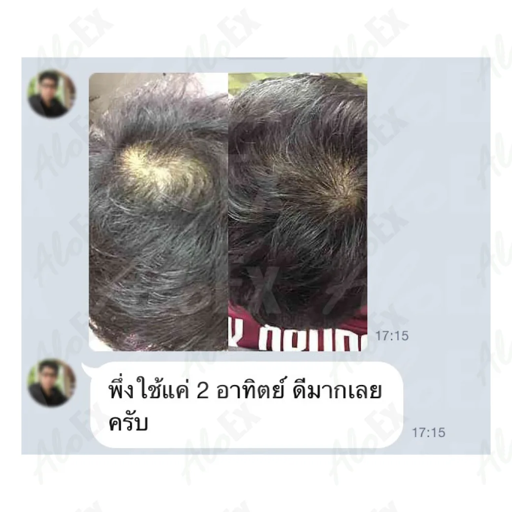 မသုံးမီနှင့် သုံးပြီးနောက် — AloEx ထုတ်ကုန်များ