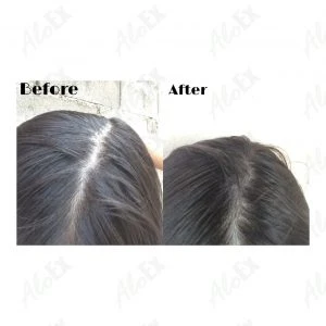 Before & After Reviews — AloEx Products