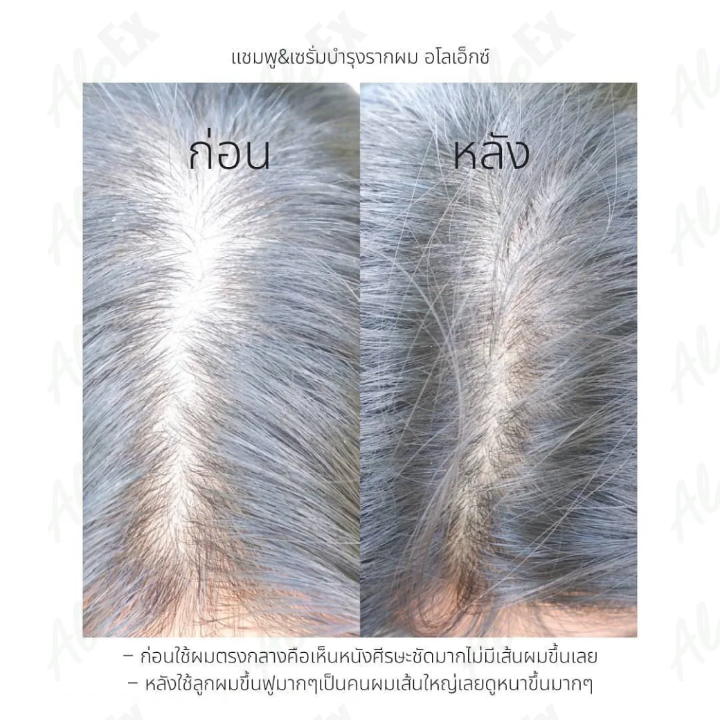 မသုံးမီနှင့် သုံးပြီးနောက် — AloEx ထုတ်ကုန်များ