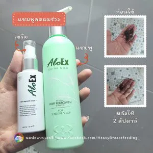 ใช้ต่อเนื่องประมาณ 2 สัปดาห์ร่วมกับเซรั่ม …เทียบผมที่ร่วง ใช้ครั้งแรกจนถึงครั้งล่าสุด ผมร่วงน้อยลงจริงๆค่ะ เลิศสมากกก