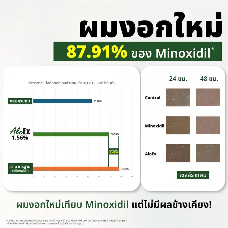 AloEx เทียบตัวยา Minoxidil