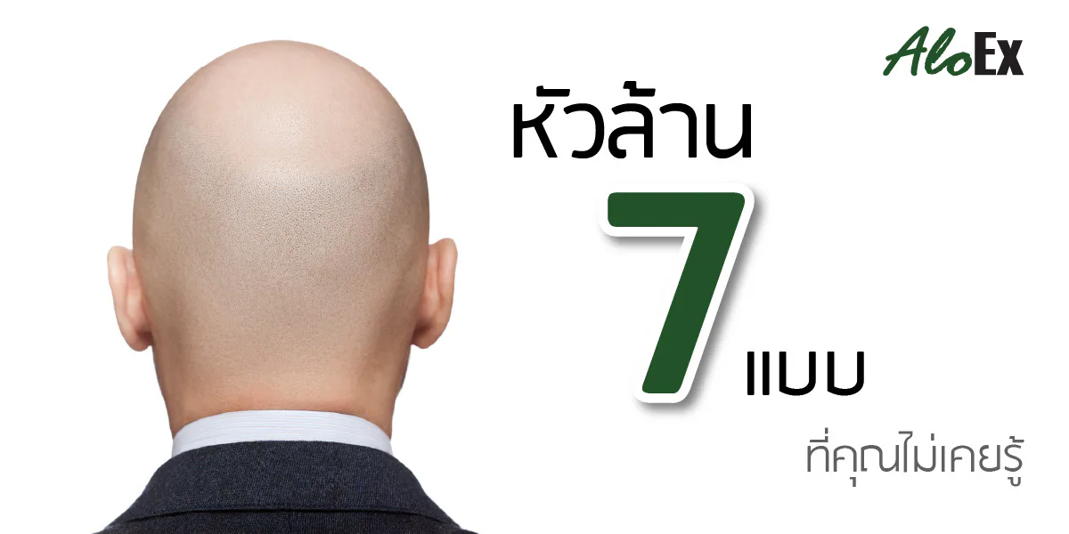 7 types of baldness