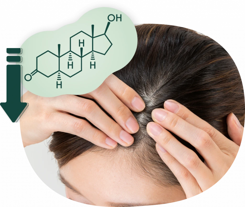 5α-reductase အင်ဇိုင်းမှတစ်ဆင့် Testosterone မှ DHT ဖြစ်ပေါ်သည့် သံသရာ