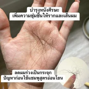 นับว่าเป็นเพิ่มสูตรที่ดีมากๆ ใช้แล้วช่วยทั้งลดผมร่วงและลดรังแคไปพร้อมกัน