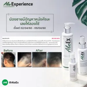 น้องชายมีปัญหาหนังศีรษะเลยให้ลองใช้