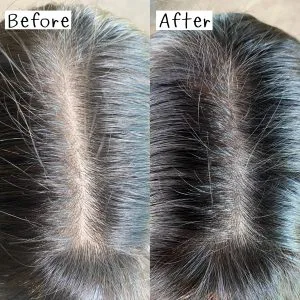 ไม่แน่ใจว่าผมที่พื้นกับบนหัวตรงไหนเยอะกว่ากัน? จึงอยากมาบอกต่อเซรั่มและ Hair Mask ของ AloExไม่แน่ใจว่าผมที่พื้นกับบนหัวตรงไหนเยอะกว่ากัน?
