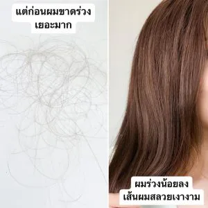 แชมพูที่ช่วยลดการขาดหลุดร่วงและกระตุ้นผมงอกใหม่ที่ดีที่สุด!!! สูตรใหม่ Aloex Extra Mild For Sensitive Scalp