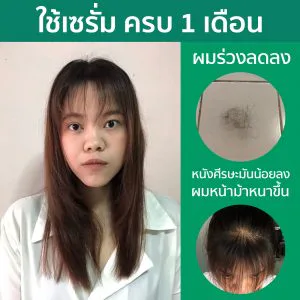 น้องเซรั่มแก้ผมร่วง ลดผมมันมาแล้วค่ะ