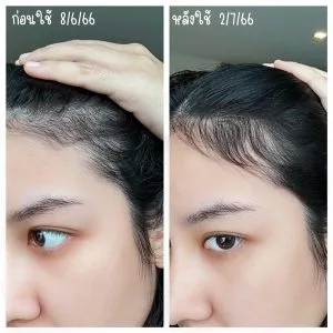 ตั้งแต่มีลูกก็คือร่วงไม่พักเลยจ้าา ตัวล่าสุดที่เราใช้แล้วเห็นผลคือ AloEx Natural Hair Maskตั้งแต่มีลูกก็คือร่วงไม่พักเลยจ้าา