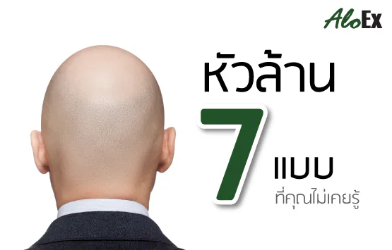 သင်တစ်ခါမှ မကြားဖူးသော ဆံပင်ကျွတ်ခြင်း ၇ မျိုး