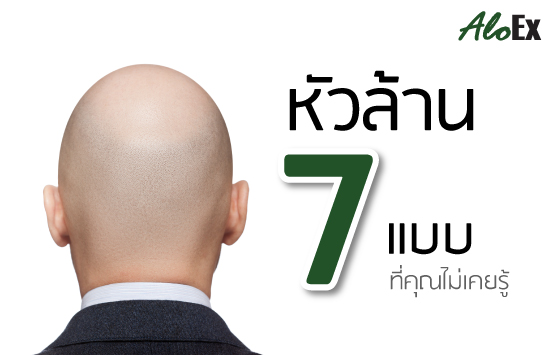 หัวล้าน 7 แบบ