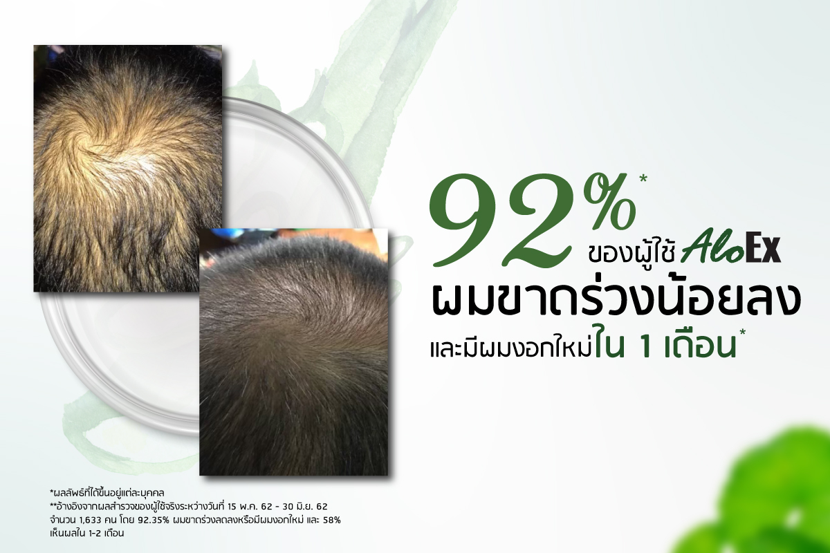 92% ของผู้ใช้ aloex ผมขาดร่วงน้อยลง และมีผมงอกใหม่ใน 1 เดือน