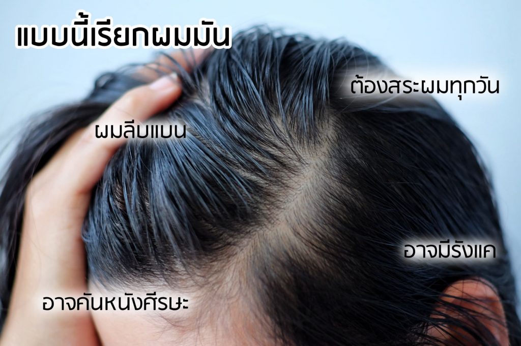 AloEx ลักษณะผมมัน